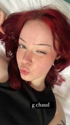 Kirapika Cos Photo #16