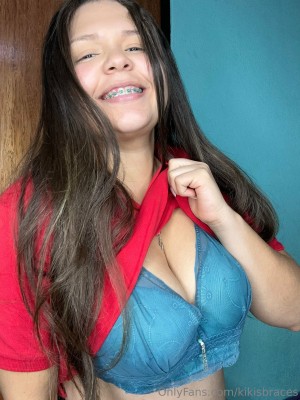 kikisbraces Photo #32