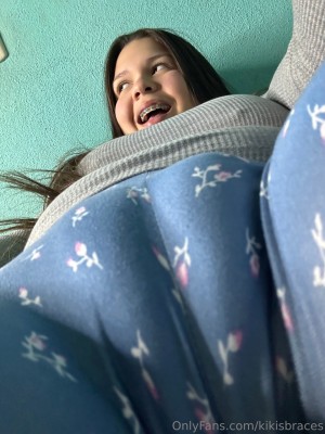 kikisbraces Photo #78