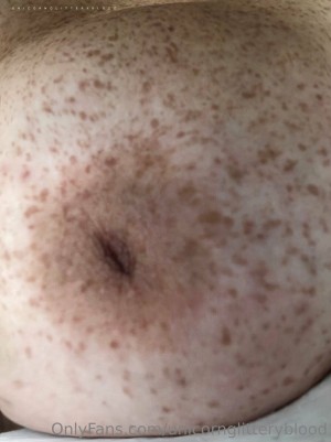 Unicornglitteryblood Photo #63