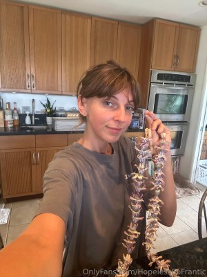 Hopelesssofrantic Photo #589