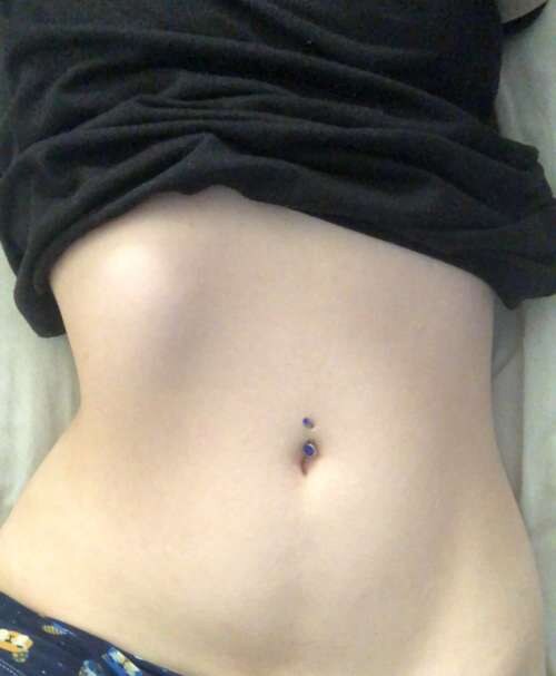 Sttaringart Photo #22