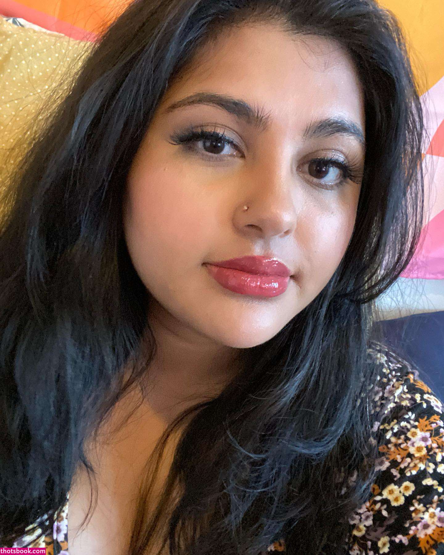 vitiligo kitten Nude Leaks OnlyFans Photos #1 1914265